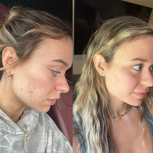 Perfection Tox Ampoule