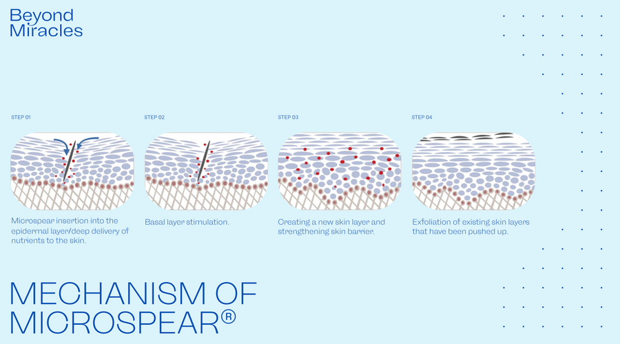 Cellstory® or Chemical Peel ? What is the Difference?