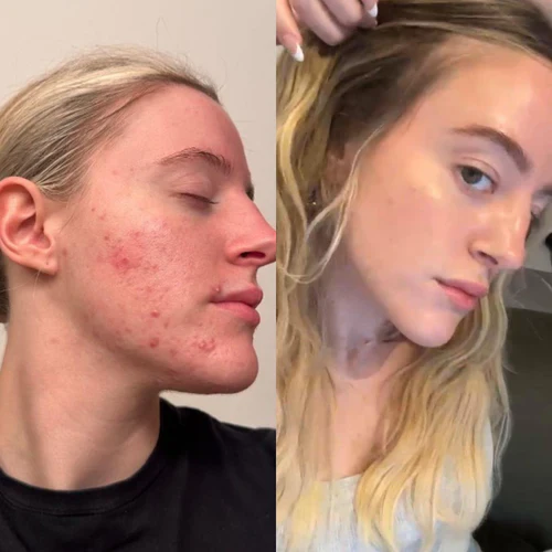 Clearer, Smoother-Looking Skin