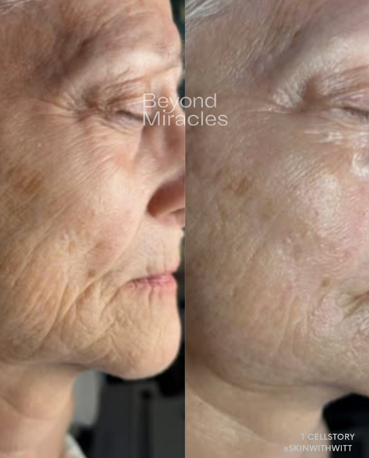 Visibly Firmer, More Youthful-Looking Skin